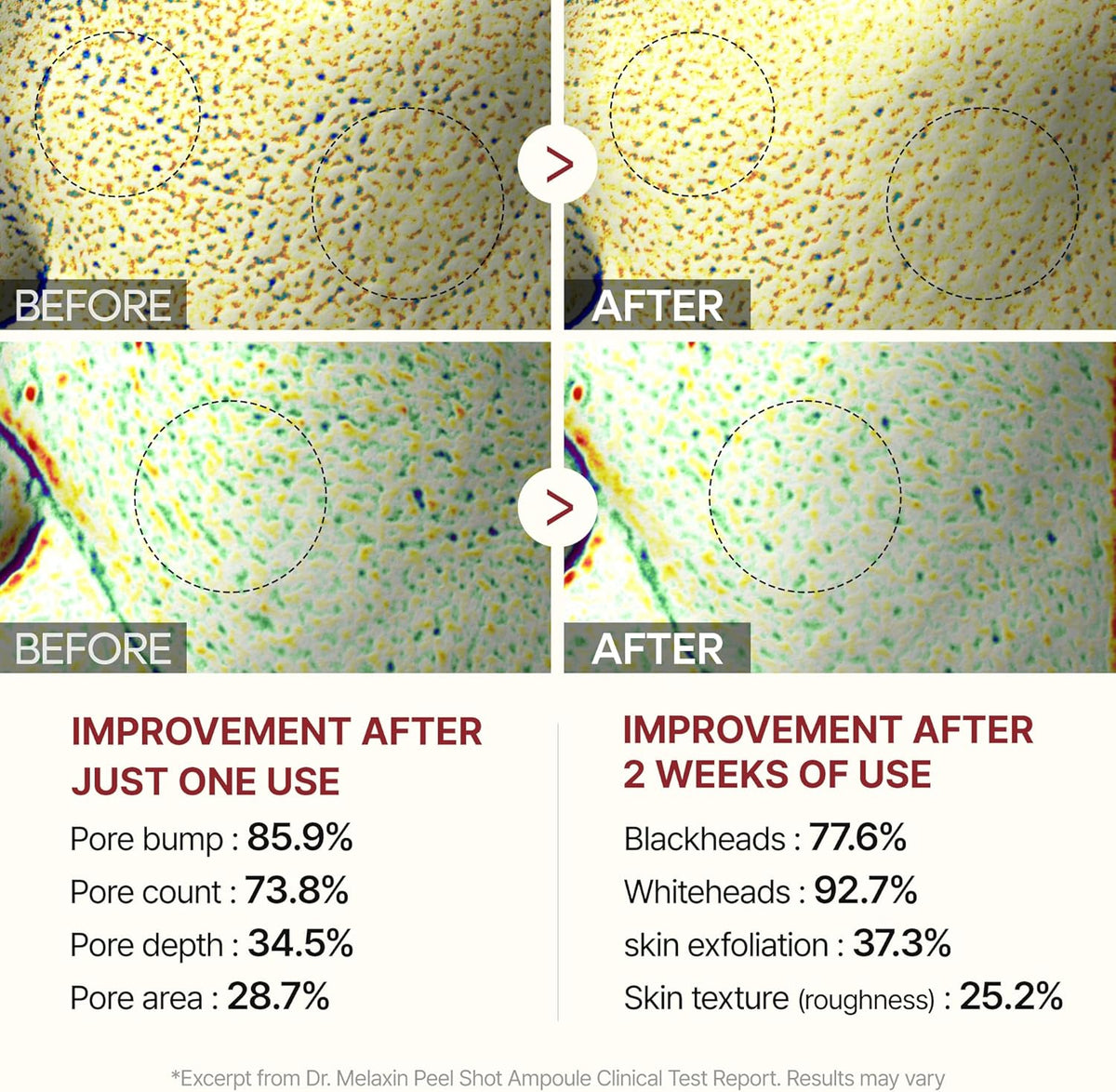 Korean Skincare 2 Bottle Set Rice Essence Vemmora